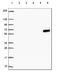 Keratin 6A antibody, HPA061168, Atlas Antibodies, Western Blot image 