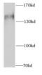 Splicing Factor 3b Subunit 3 antibody, FNab07779, FineTest, Western Blot image 