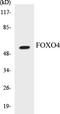 Forkhead Box O4 antibody, EKC1224, Boster Biological Technology, Western Blot image 