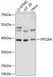 VPS26, Retromer Complex Component A antibody, 15-456, ProSci, Western Blot image 