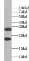 Zinc Finger Protein 146 antibody, FNab09659, FineTest, Western Blot image 