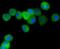Protein Phosphatase 1 Regulatory Inhibitor Subunit 1A antibody, A11390, Boster Biological Technology, Immunocytochemistry image 