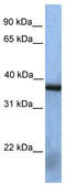 N(Alpha)-Acetyltransferase 30, NatC Catalytic Subunit antibody, TA346682, Origene, Western Blot image 