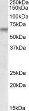 Tetratricopeptide Repeat Domain 8 antibody, NBP1-49869, Novus Biologicals, Western Blot image 