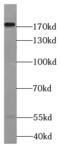 Laminin Subunit Gamma 3 antibody, FNab04680, FineTest, Western Blot image 