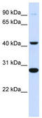 Cytochrome b-561 antibody, TA346310, Origene, Western Blot image 