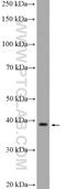 Ankyrin Repeat Domain 16 antibody, 24334-1-AP, Proteintech Group, Western Blot image 