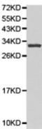 SPINK1 antibody, TA322899, Origene, Western Blot image 