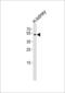 Folate Hydrolase 1B antibody, LS-C162226, Lifespan Biosciences, Western Blot image 