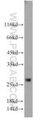 Mitochondrial Assembly Of Ribosomal Large Subunit 1 antibody, 22838-1-AP, Proteintech Group, Western Blot image 