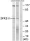 Serine And Arginine Rich Splicing Factor 11 antibody, A30765, Boster Biological Technology, Western Blot image 