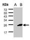 Ubiquitin Conjugating Enzyme E2 F (Putative) antibody, PA5-28641, Invitrogen Antibodies, Western Blot image 