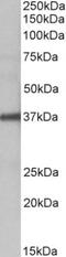 SEC2 antibody, NBP2-26116, Novus Biologicals, Western Blot image 