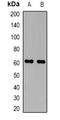 Perforin 1 antibody, orb382652, Biorbyt, Western Blot image 