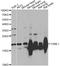 Visinin-like protein 1 antibody, A2797, ABclonal Technology, Western Blot image 