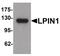 Phosphatidate phosphatase LPIN1 antibody, PA5-34566, Invitrogen Antibodies, Western Blot image 