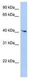 Protein lyl-1 antibody, TA329261, Origene, Western Blot image 