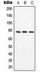 Solute Carrier Family 15 Member 1 antibody, LS-C352856, Lifespan Biosciences, Western Blot image 