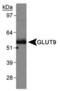 Solute Carrier Family 2 Member 6 antibody, PA5-22966, Invitrogen Antibodies, Western Blot image 