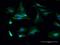 BUB1 Mitotic Checkpoint Serine/Threonine Kinase antibody, H00000699-D01P, Novus Biologicals, Immunocytochemistry image 