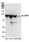 Exportin 1 antibody, A300-469A, Bethyl Labs, Western Blot image 