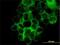 Laminin subunit beta-3 antibody, H00003914-M01, Novus Biologicals, Immunocytochemistry image 
