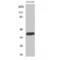 Solute Carrier Family 22 Member 18 antibody, LS-C385237, Lifespan Biosciences, Western Blot image 