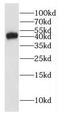 GLI Family Zinc Finger 4 antibody, FNab03479, FineTest, Western Blot image 