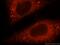 Pyruvate carboxylase, mitochondrial antibody, 16588-1-AP, Proteintech Group, Immunofluorescence image 