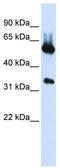 5'-Aminolevulinate Synthase 2 antibody, TA346149, Origene, Western Blot image 