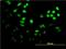 Forkhead box protein F2 antibody, H00002295-M04, Novus Biologicals, Immunofluorescence image 