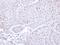 Proteasome 26S Subunit, ATPase 3 antibody, LS-C186085, Lifespan Biosciences, Immunohistochemistry frozen image 