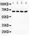 NADPH oxidase 1 antibody, PA5-79752, Invitrogen Antibodies, Western Blot image 