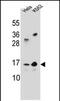 LOC391742 antibody, PA5-71796, Invitrogen Antibodies, Western Blot image 