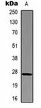 Putative overexpressed in colon carcinoma 1 protein antibody, orb75133, Biorbyt, Western Blot image 