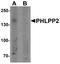 PH Domain And Leucine Rich Repeat Protein Phosphatase 2 antibody, A04110, Boster Biological Technology, Western Blot image 