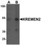Kringle Containing Transmembrane Protein 2 antibody, LS-C201058, Lifespan Biosciences, Western Blot image 