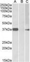 Myogenic factor 6 antibody, TA311235, Origene, Western Blot image 
