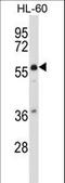 Mucolipin 3 antibody, LS-C164099, Lifespan Biosciences, Western Blot image 
