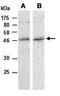 NSE2 (MMS21) Homolog, SMC5-SMC6 Complex SUMO Ligase antibody, orb67033, Biorbyt, Western Blot image 
