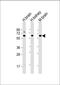 Glutaminase antibody, GTX81012, GeneTex, Western Blot image 