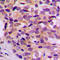 ATP Synthase Membrane Subunit C Locus 2 antibody, LS-C354546, Lifespan Biosciences, Immunohistochemistry paraffin image 