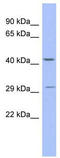 Zinc Finger Protein 575 antibody, TA345601, Origene, Western Blot image 