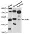 P2X purinoceptor 3 antibody, LS-C747997, Lifespan Biosciences, Western Blot image 