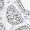 Single-Pass Membrane Protein With Coiled-Coil Domains 2 antibody, NBP1-93547, Novus Biologicals, Immunohistochemistry frozen image 