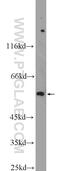 T-Box 15 antibody, 25148-1-AP, Proteintech Group, Western Blot image 