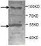 ADAM Metallopeptidase With Thrombospondin Type 1 Motif 8 antibody, TA310095, Origene, Western Blot image 
