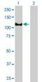 Erythrocyte Membrane Protein Band 4.1 antibody, H00002035-M01, Novus Biologicals, Western Blot image 
