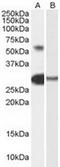 Transcription Factor Like 5 antibody, TA303152, Origene, Western Blot image 