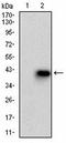 Keratin 3 antibody, orb182908, Biorbyt, Western Blot image 
